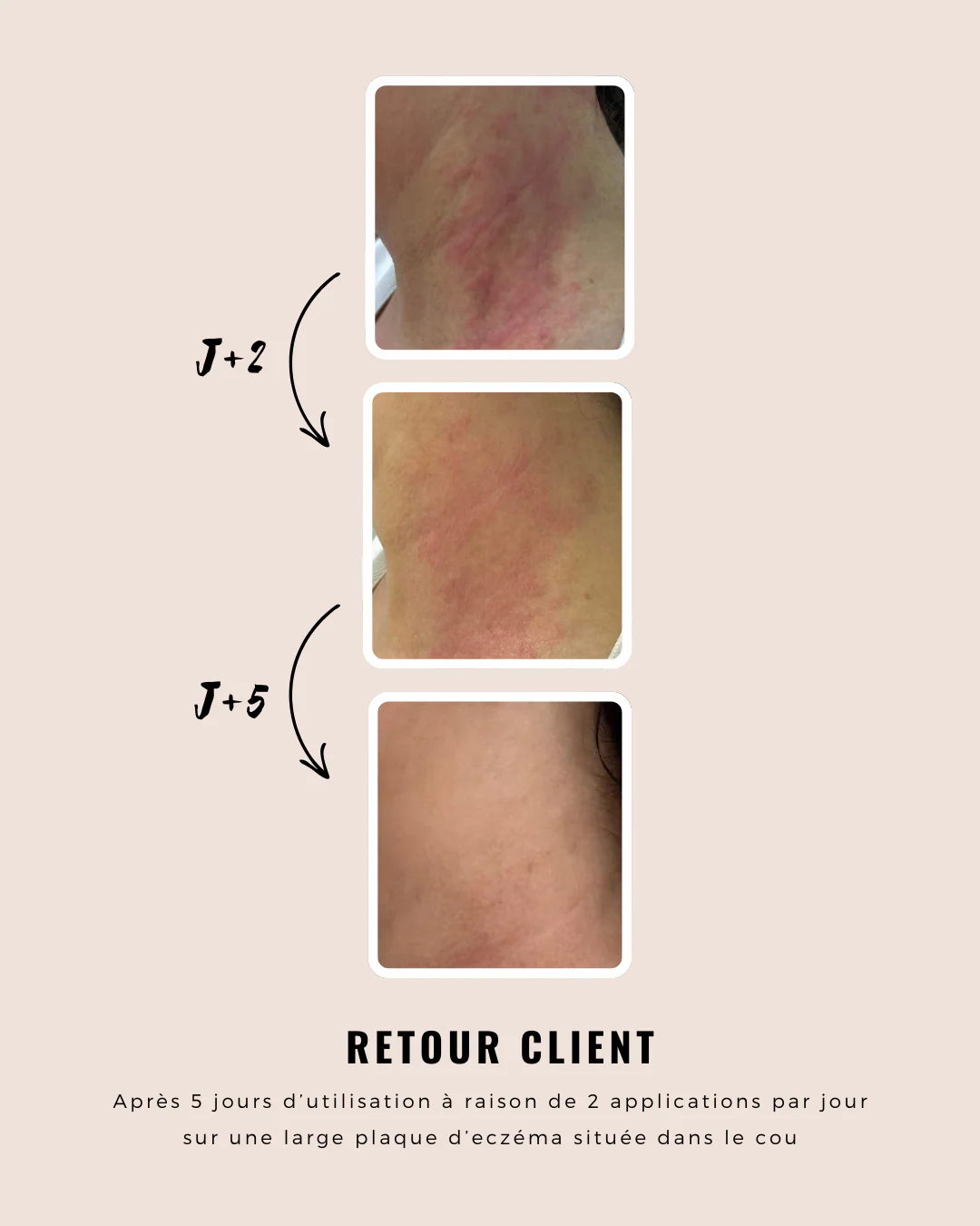 Dermo-Repairing Gel