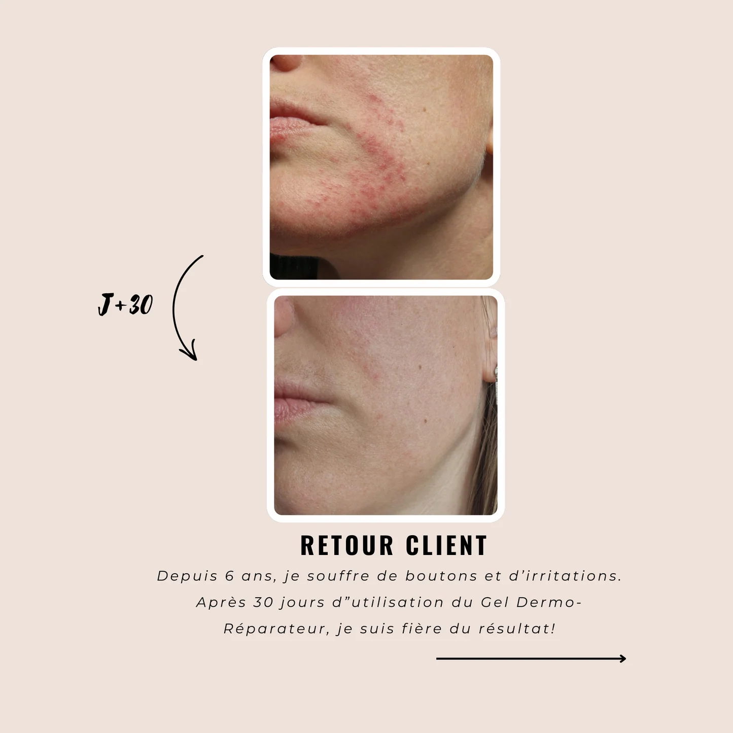 Dermo-Repairing Gel
